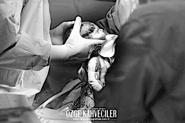 amerikan-hastanesi-dogumfotografcisi copy