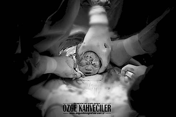 zeytinburnu-dogumfotografcisi copy