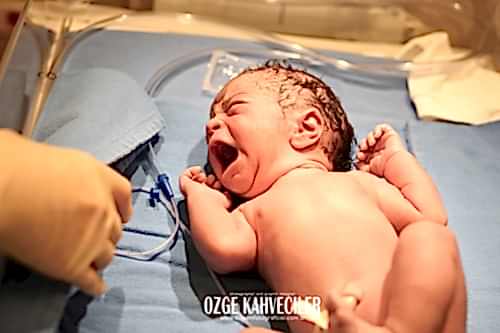 koç üniversitesi hastanesi doğum çekimleri 20