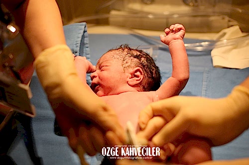 koç üniversitesi hastanesi doğum çekimleri 23